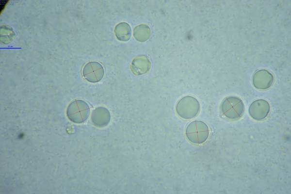 amanita-gaver-spore-copiaBA282C05-1B88-2C7B-59B9-15638B66C31D.jpg