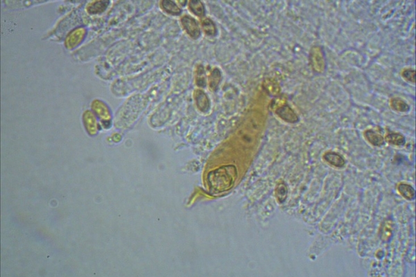 hypholoma-sp-cistidi-1000-8-koh-5-copia62CA4DB1-4F1F-561F-872D-C846E41A3FE8.jpg