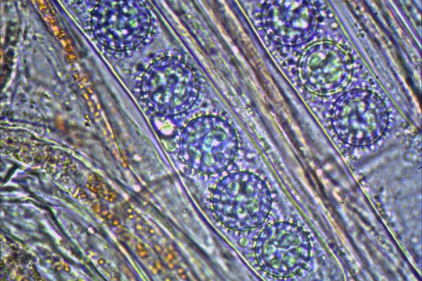 scutellinia-trechispora-1000-luneto-2-copia2A3DC831-0909-5667-BF5E-FA075ACFA813.jpg