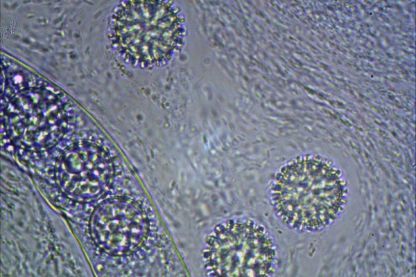 scutellinia-trechispora-1000-luneto-6-copiaFC59673E-86C4-500B-2FC7-1D21767A3048.jpg